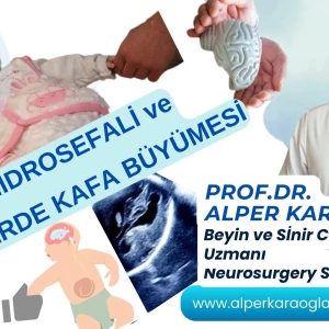 Akut HİDROSEFALİ ve BEBEKLERDE (YENİDOĞANDA) KAFA BÜYÜMESİ | Prof.Dr. Alper KARAOĞLAN makalesi