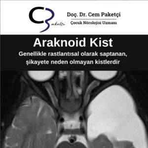 ARAKNOİD KİST makalesi