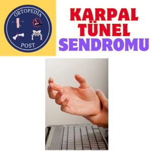 KARPAL TÜNEL SENDROMU makalesi