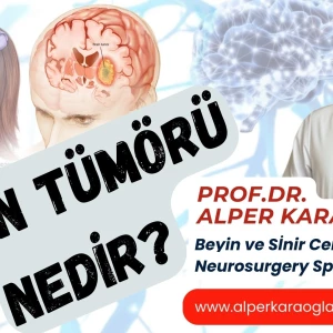 BEYİN TÜMÖRÜ Nedir? makalesi