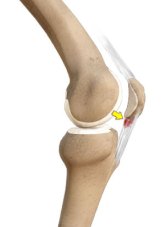 Patellar tendinit ve ön diz ağrısı