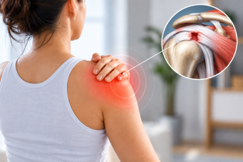 Rotator cuff yırtığı nedir? belirtileri ve tedavi yöntemleri