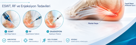 Topuk dikeni nedir? eswt, radyofrekans ve enjeksiyon tedavileri