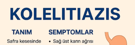 Kolelitiazis (safra kesesi taşı) hasta bilgilendirme metni