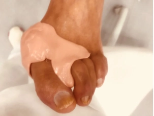 Ayak silikon ortezleri nedir ?