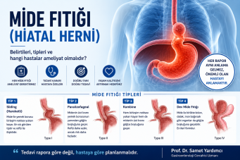 Mide fıtığı (hiatal herni) nedir?