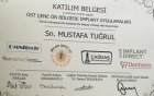 İmplant