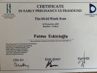 Gebelikte tarama testleri