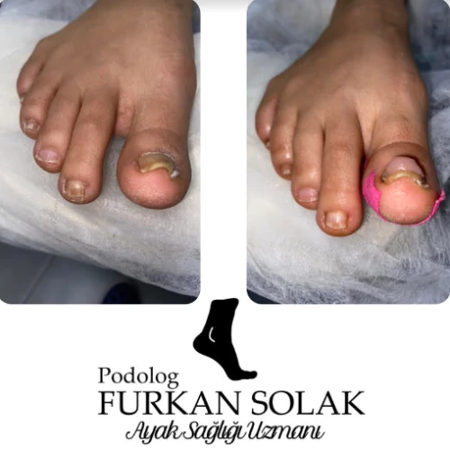 Klinik Fotoğrafı