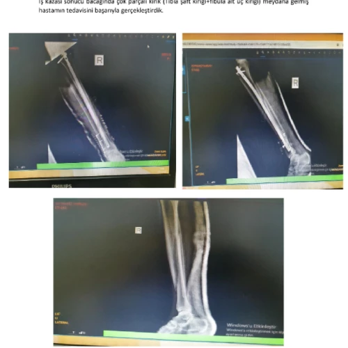 Klinik Fotoğrafı