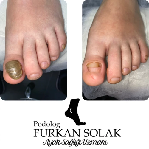 Klinik Fotoğrafı