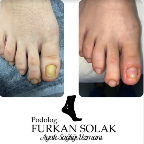 Klinik Fotoğrafı