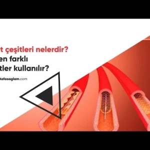 Stent çeşitleri nelerdir? Prof. Dr. Mustafa Sağlam
