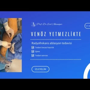 Venöz Yetmezlikte Radyofrekans Ablasyon Tedavisi