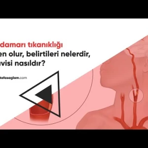 Şah Damarı Tıkanıklığı - Prof. Dr. Mustafa Sağlam