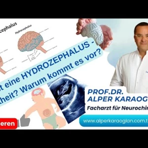 Was ist eine HYDROZEPHALUS-Krankheit? Warum kommt es vor? | Prof.Dr. Alper KARAOGLAN