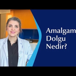 Amalgam Dolgu Nedir?