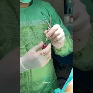Genel Anestezi / Arifağa Diş Polikliniği