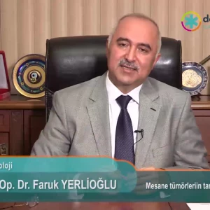 Mesane tümörlerinin tanı ve tedavisi nasıldır?