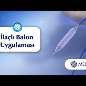 İdrar Kanalı Daralmasında İlaçlı Balon Uygulaması Nedir?