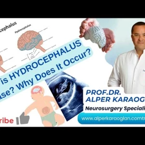 What is HYDROCEPHALUS Disease? Why Does It Occur? | Prof Dr Alper KARAOGLAN