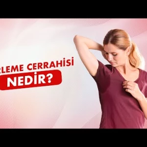 Aşırı Terlemenin Cerrahi Tedavisi Nasıl Yapılır?│Prof. Dr. Güven Sadi Sunam