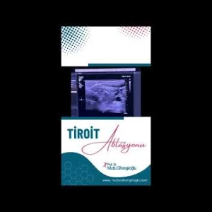 TİROİT ABLASYONU