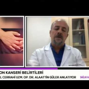 Kolon ve Rektum kanserleri