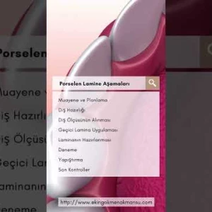 Porselen Lamine