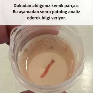 Biyopsi Nedir?