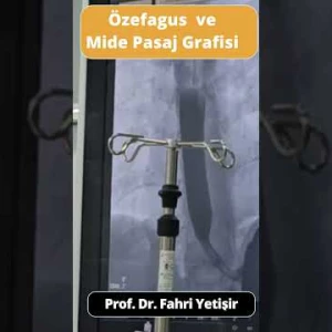Dinamik Skopi ile Özefagus-Mide Pasajı ve Reflü Değerlendirmesi