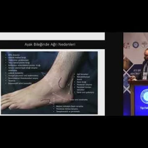01. Ayak Bileği Artroskopisinde Endikasyonlar - Dr. Abdurrahman Vural