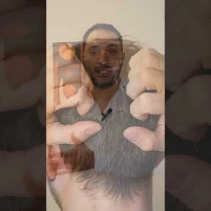 Saç Dökülmesi