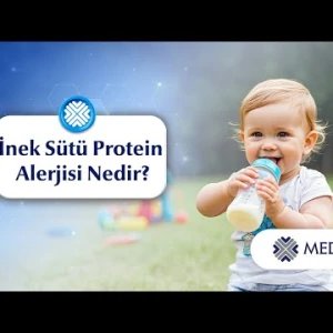 Bebeklerde İnek Sütü Protein Alerjisinin Belirtileri Nelerdir?