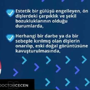 Porselen lamina nedir? Tedavi süreci nasıl işliyor? Cevabı videomuzda🎬