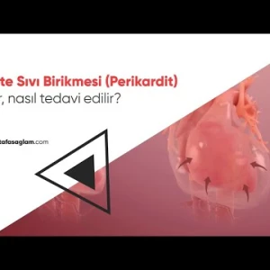 Kalpte Sıvı Birikmesi ( Perikardit)