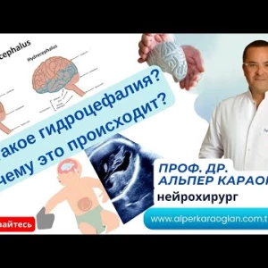 Что такое гидроцефалия? Почему это происходит? | Проф. Др. Альпер КАРАОГЛАН
