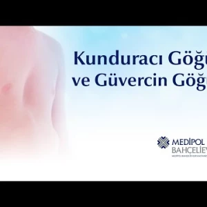 Bir Bilene Sor: Kunduracı Göğüs ve Güvercin Göğüs tedavisi