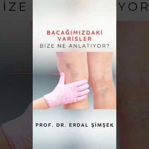 Bacağımızdaki varisler bize ne anlatıyor