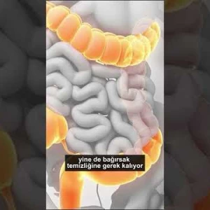 Sanal Kolonoskopi Nedir ?