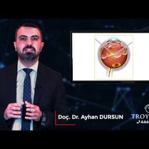 Doç. Dr. Ayhan DURSUN Diyanetik Diyabetik Retinopati Nedir ?