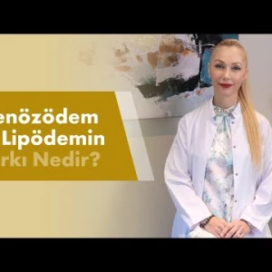Venözödem ile Lipödemin Farkı