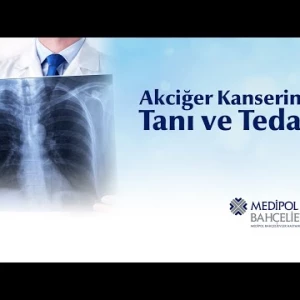 Akciğer Kanseri: Semptomlardan Tedaviye Kadar Detaylı Bir Bakış