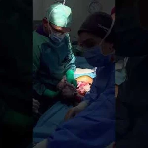 Üçüz Gebelik Sezaryen
