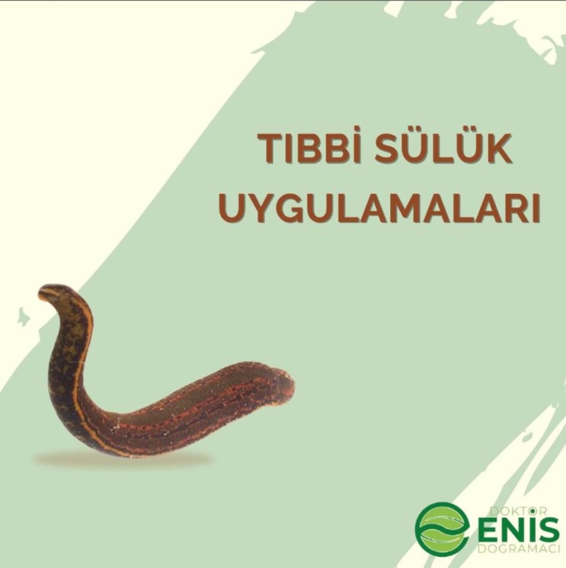 Tıbbi Sülük Uygulamaları