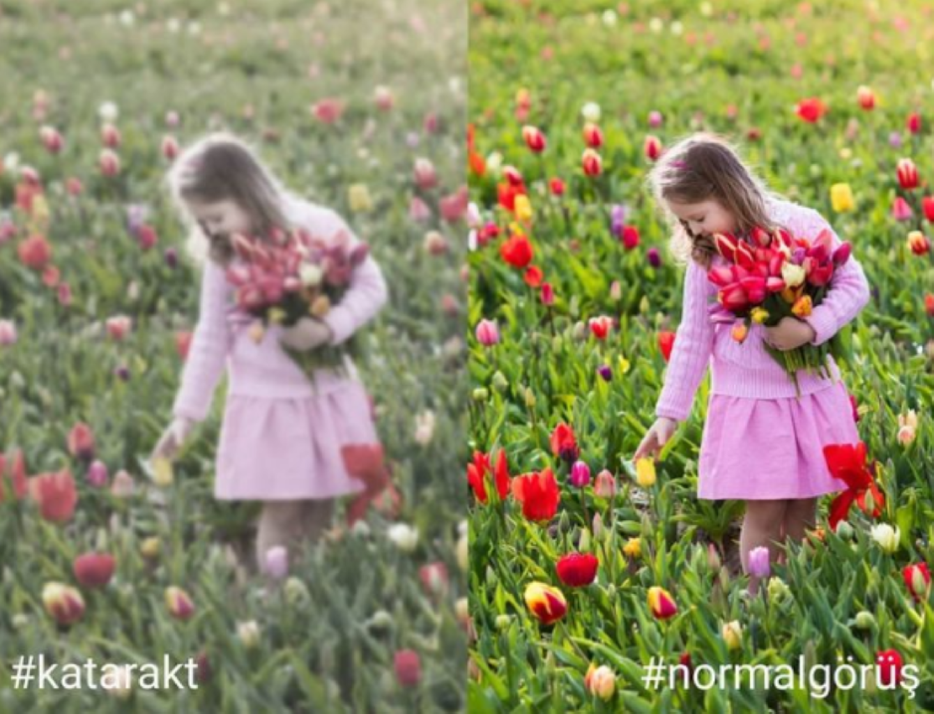 Katarakt nedir? Nasıl tedavi edilir?