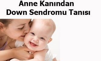 Anne kanından down sendromu makalesi