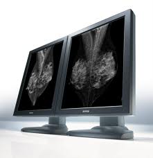 Mammografi
