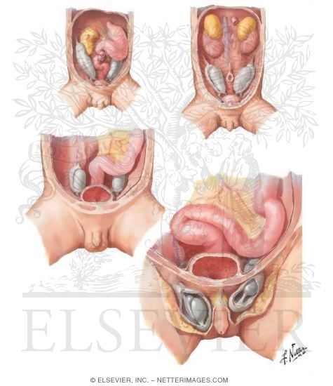 İnmemiş testis nedir?