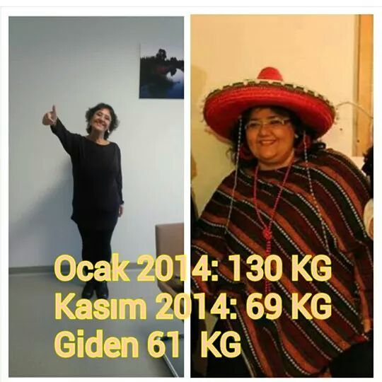 Obezıte cerrahısı sonrası 5 haftalık dıyet lıstesı